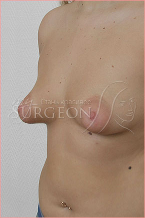 красивые груди — это мой хирург!